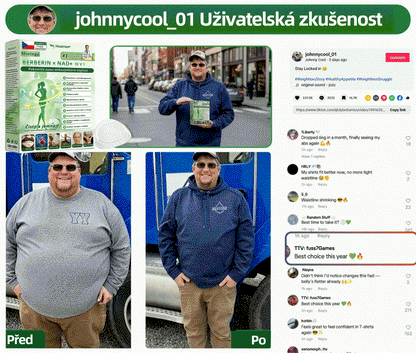 Oficiální obchod | 🧑‍⚕️ 𝑯𝒆𝒂𝒍𝒓𝒊𝒛𝒆® 𝑴𝒐𝒓𝒊𝒏𝒈𝒂 · 𝑩𝒆𝒓𝒃𝒆𝒓𝒊𝒏𝒆 × 𝑵𝑨𝑫+ 10𝒗1 𝑷𝒐𝒌𝒓𝒐č𝒊𝒍á 𝑵𝒂𝒏𝒐 𝑴𝒊𝒌𝒓𝒐č𝒆𝒑𝒆𝒍𝒐𝒗á 𝑵á𝒑𝒍𝒂𝒔𝒕(Pouze jednou denně, viditelné změny již za 7 dní) ✅ Pro obezitu, 🅞🅒🅗🅐🅑🅛🅞🅤 🅟🅞🅚🅞ž🅚🅤, cukrovku, spánkovou apnoe, problémy s klouby a další🌿