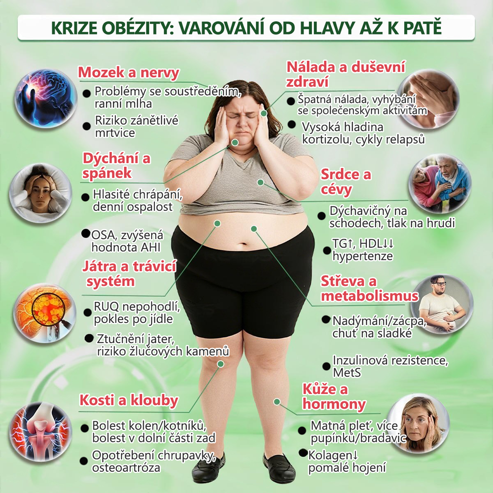 Oficiální obchod | 🧑‍⚕️ 𝑯𝒆𝒂𝒍𝒓𝒊𝒛𝒆® 𝑴𝒐𝒓𝒊𝒏𝒈𝒂 · 𝑩𝒆𝒓𝒃𝒆𝒓𝒊𝒏𝒆 × 𝑵𝑨𝑫+ 10𝒗1 𝑷𝒐𝒌𝒓𝒐č𝒊𝒍á 𝑵𝒂𝒏𝒐 𝑴𝒊𝒌𝒓𝒐č𝒆𝒑𝒆𝒍𝒐𝒗á 𝑵á𝒑𝒍𝒂𝒔𝒕(Pouze jednou denně, viditelné změny již za 7 dní) ✅ Pro obezitu, 🅞🅒🅗🅐🅑🅛🅞🅤 🅟🅞🅚🅞ž🅚🅤, cukrovku, spánkovou apnoe, problémy s klouby a další🌿