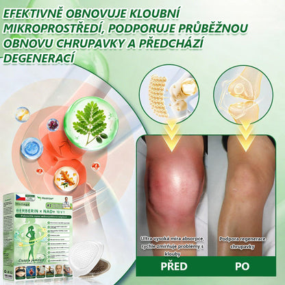 Oficiální obchod | 🧑‍⚕️ 𝑯𝒆𝒂𝒍𝒓𝒊𝒛𝒆® 𝑴𝒐𝒓𝒊𝒏𝒈𝒂 · 𝑩𝒆𝒓𝒃𝒆𝒓𝒊𝒏𝒆 × 𝑵𝑨𝑫+ 10𝒗1 𝑷𝒐𝒌𝒓𝒐č𝒊𝒍á 𝑵𝒂𝒏𝒐 𝑴𝒊𝒌𝒓𝒐č𝒆𝒑𝒆𝒍𝒐𝒗á 𝑵á𝒑𝒍𝒂𝒔𝒕(Pouze jednou denně, viditelné změny již za 7 dní) ✅ Pro obezitu, 🅞🅒🅗🅐🅑🅛🅞🅤 🅟🅞🅚🅞ž🅚🅤, cukrovku, spánkovou apnoe, problémy s klouby a další🌿
