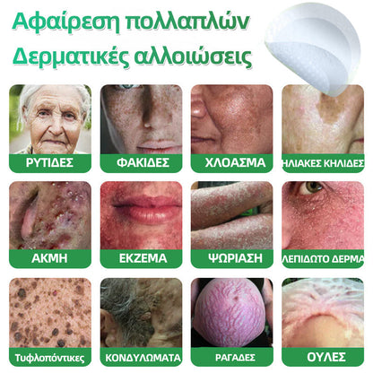 𝐇𝐮𝐝𝐫𝐨𝐬® 📌𝟐-σε-𝟏 υδροκολλοειδή επιθέματα με μικροβελόνες | 🧪Ειδικά σχεδιασμένα για την αφαίρεση υπερυψωμένων σπίλων, ακμής, επίπεδων μυρμηγκιών και δερματικών μορφωμάτων | Συσκευασία 𝟏𝟒𝟒 τεμαχίων🌴🌴