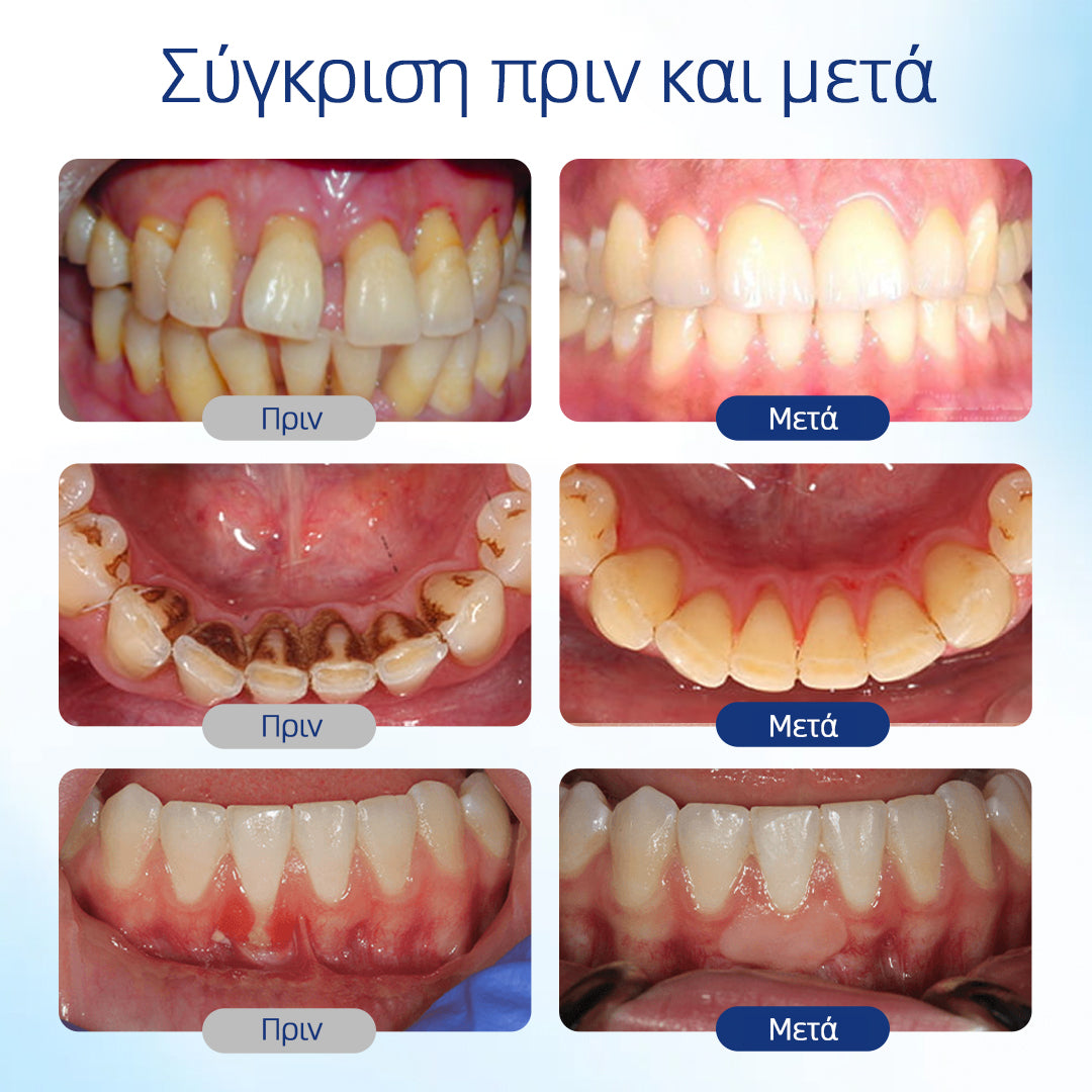 𝗛𝗘𝗔𝗧𝗪𝗢𝗟𝗙® 🛒𝗕𝗲𝗲𝗧𝗮𝗸𝘁 Διάλυμα για την αναγέννηση της στοματικής κοιλότητας 🍋🍋