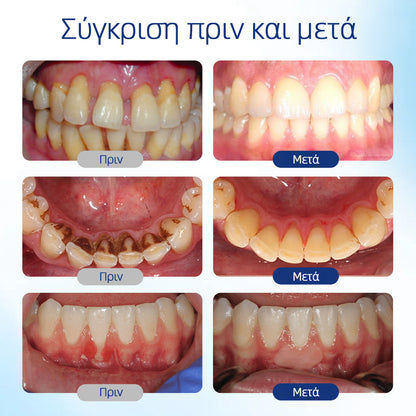 𝗛𝗘𝗔𝗧𝗪𝗢𝗟𝗙® 🛒𝗕𝗲𝗲𝗧𝗮𝗸𝘁 Διάλυμα για την αναγέννηση της στοματικής κοιλότητας 🍋🍋