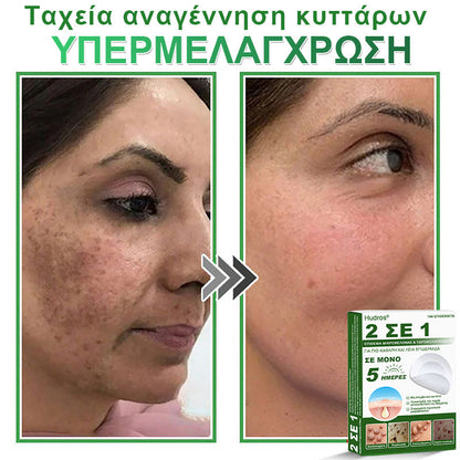 𝐇𝐮𝐝𝐫𝐨𝐬® 📌𝟐-σε-𝟏 υδροκολλοειδή επιθέματα με μικροβελόνες | 🧪Ειδικά σχεδιασμένα για την αφαίρεση υπερυψωμένων σπίλων, ακμής, επίπεδων μυρμηγκιών και δερματικών μορφωμάτων | Συσκευασία 𝟏𝟒𝟒 τεμαχίων🌴🌴