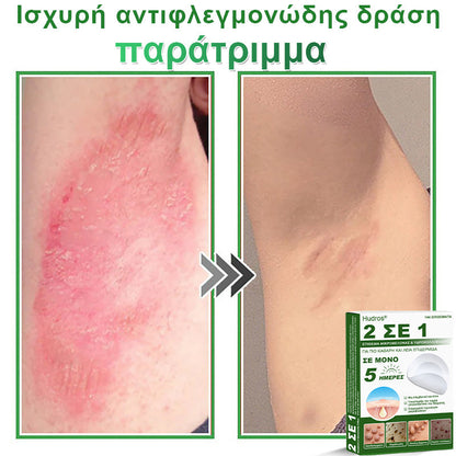 𝐇𝐮𝐝𝐫𝐨𝐬® 📌𝟐-σε-𝟏 υδροκολλοειδή επιθέματα με μικροβελόνες | 🧪Ειδικά σχεδιασμένα για την αφαίρεση υπερυψωμένων σπίλων, ακμής, επίπεδων μυρμηγκιών και δερματικών μορφωμάτων | Συσκευασία 𝟏𝟒𝟒 τεμαχίων🌴🌴