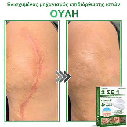 𝐇𝐮𝐝𝐫𝐨𝐬® 📌𝟐-σε-𝟏 υδροκολλοειδή επιθέματα με μικροβελόνες | 🧪Ειδικά σχεδιασμένα για την αφαίρεση υπερυψωμένων σπίλων, ακμής, επίπεδων μυρμηγκιών και δερματικών μορφωμάτων | Συσκευασία 𝟏𝟒𝟒 τεμαχίων🌴🌴