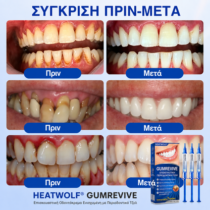 🇬🇷👨‍⚕️✅🦷HEATWOLF® GumRevive Γέλη Επιδιόρθωσης Περιοδοντίτιδας🍿