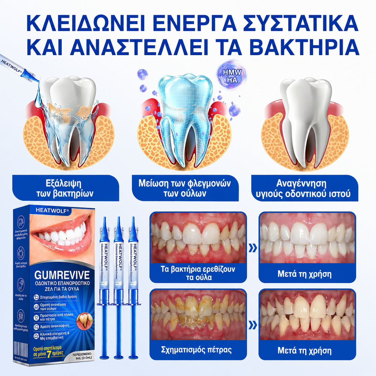 🇬🇷👨‍⚕️✅🦷HEATWOLF® GumRevive Γέλη Επιδιόρθωσης Περιοδοντίτιδας🍿